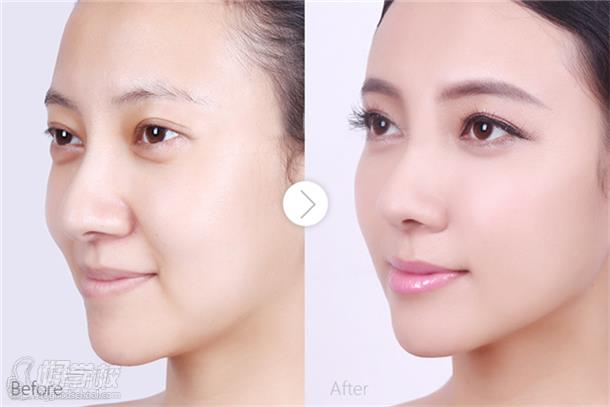 广州慧美美容培训学校